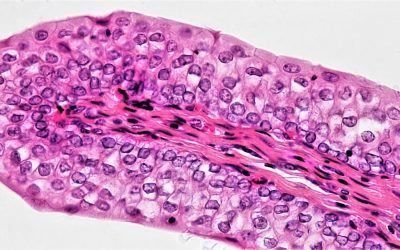 Draw-In Maneuver: Incontinence Prevention