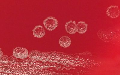 Six-Pack Revealed: The Rectus Abdominis Truth