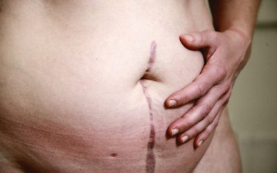 Kickstart Your Health: A Realistic 1-Week Diet Plan for Fat Loss